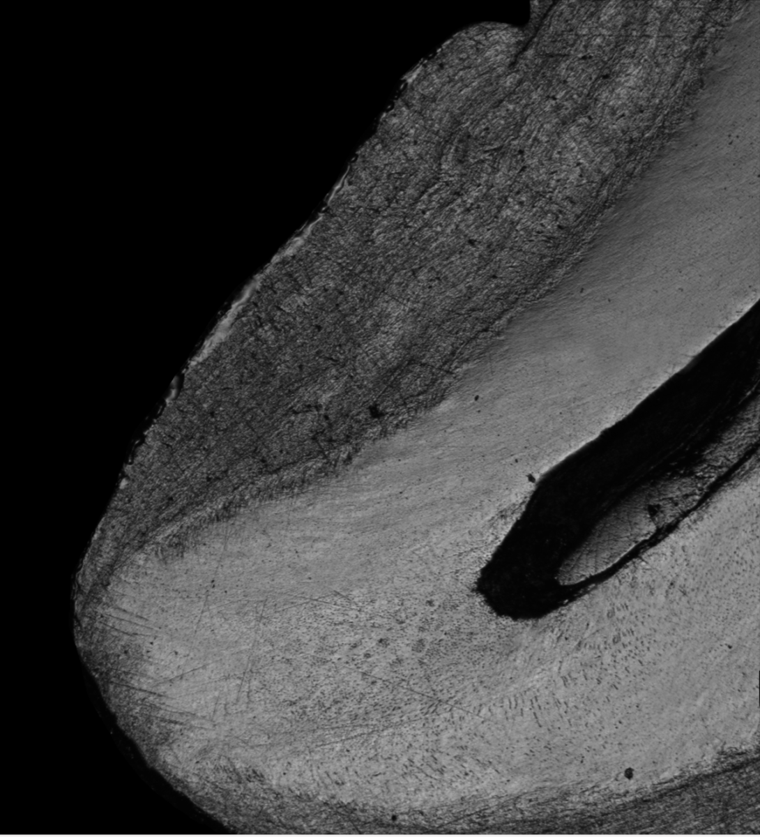 A microscopic view of Biochemical and Mechanical Adaptations of Cementum During Aging and Periodontal Disease.