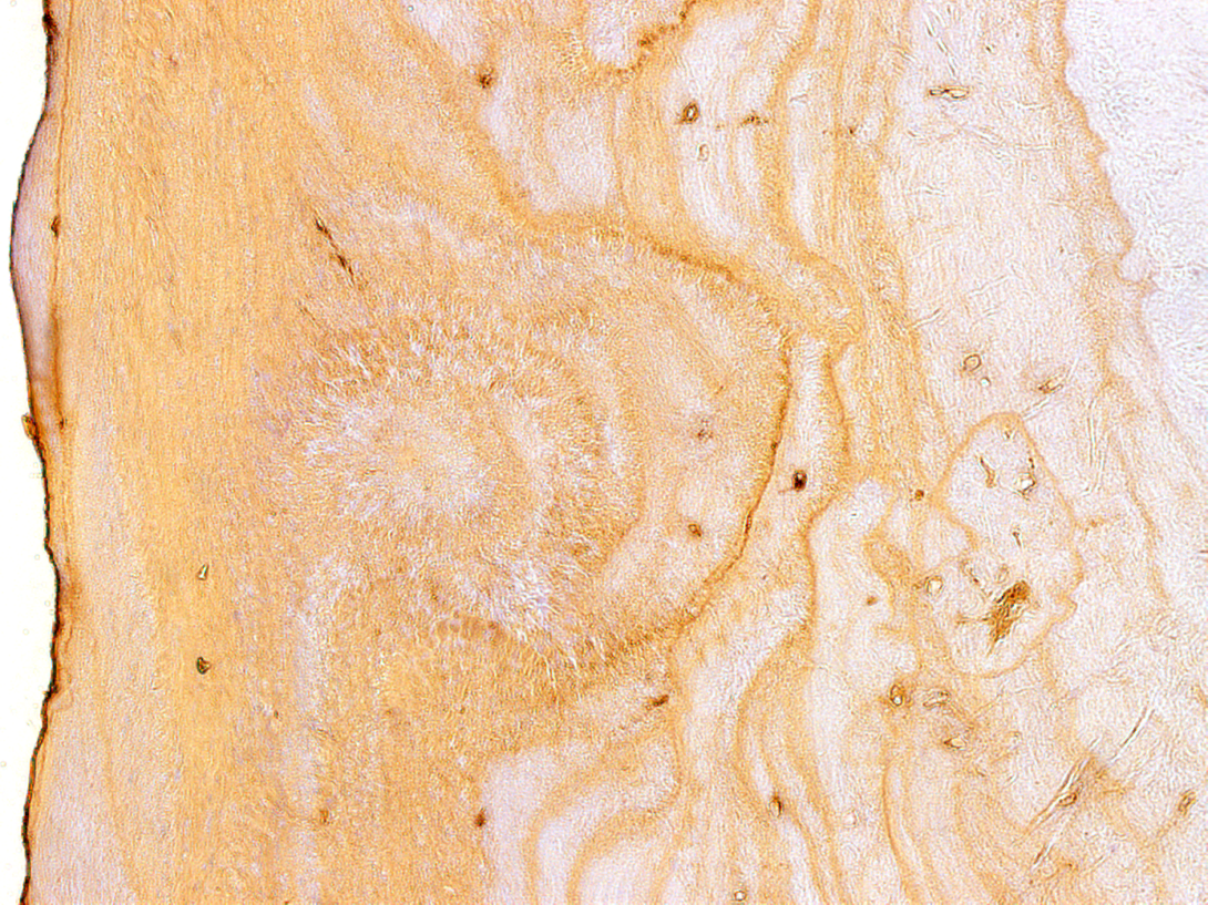 A microscopic view of Cementum Matrix Dynamics in Aging and Periodontal Disease.